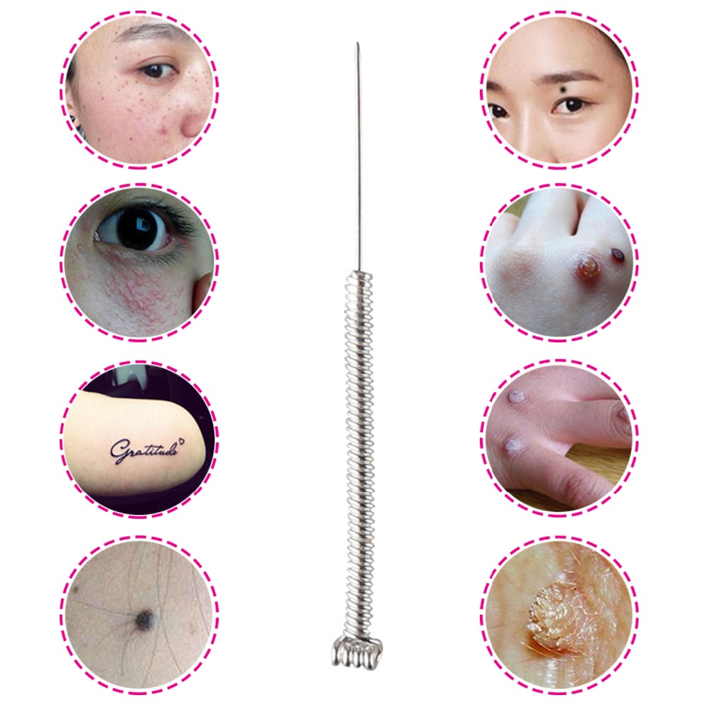 100&200Pcs Plasma Pen Needle f - Industrial Laser Cleaning Machine review and price